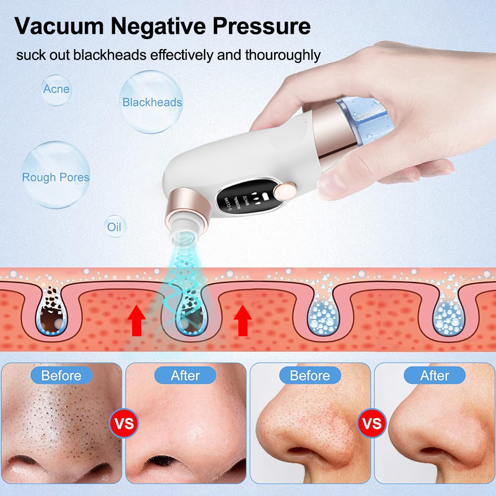 Blackhead Remover Electric Bla – Air Bubble Remover Bewertung und Preis